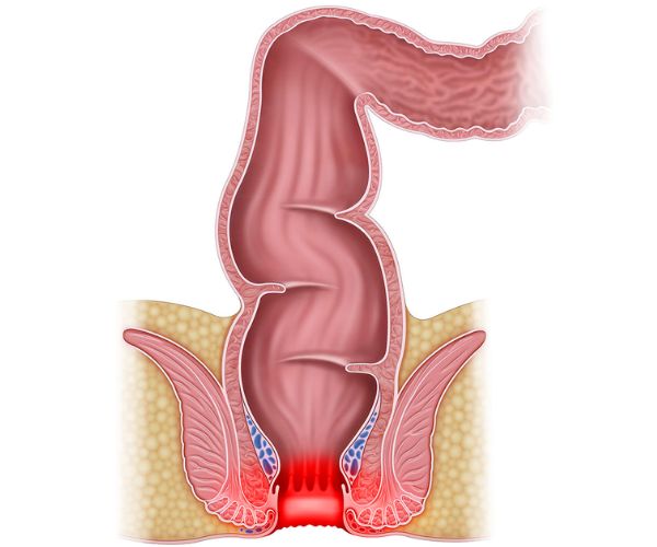 اسباب الم فتحة الشرج