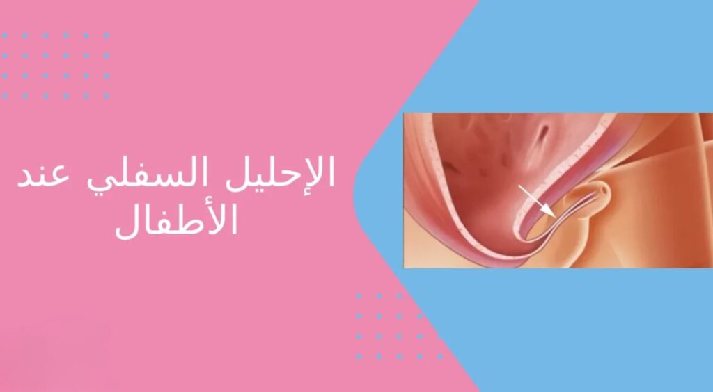 درجات الإحليل السفلي