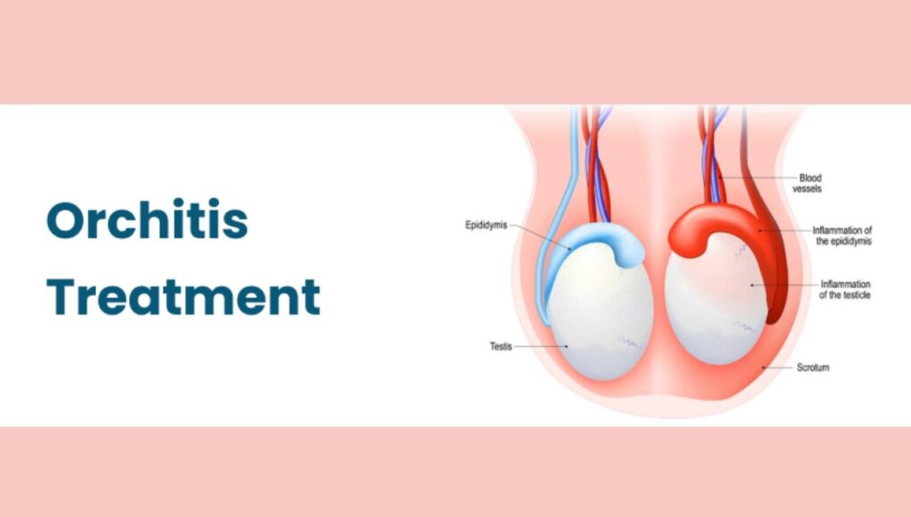 علاج التهاب الخصية عند الاطفال