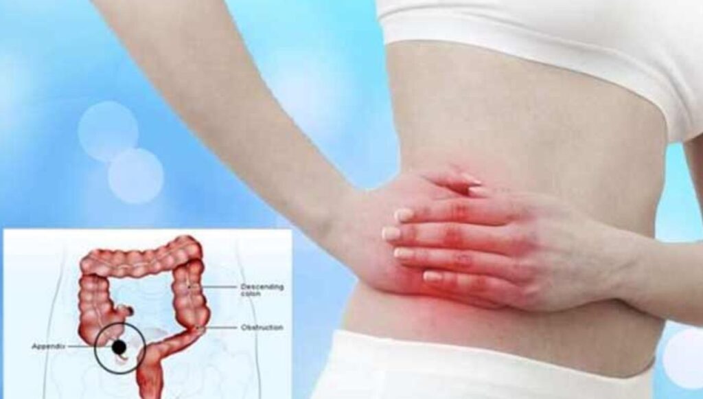 المضاعفات بعد عملية الزائدة الدودية