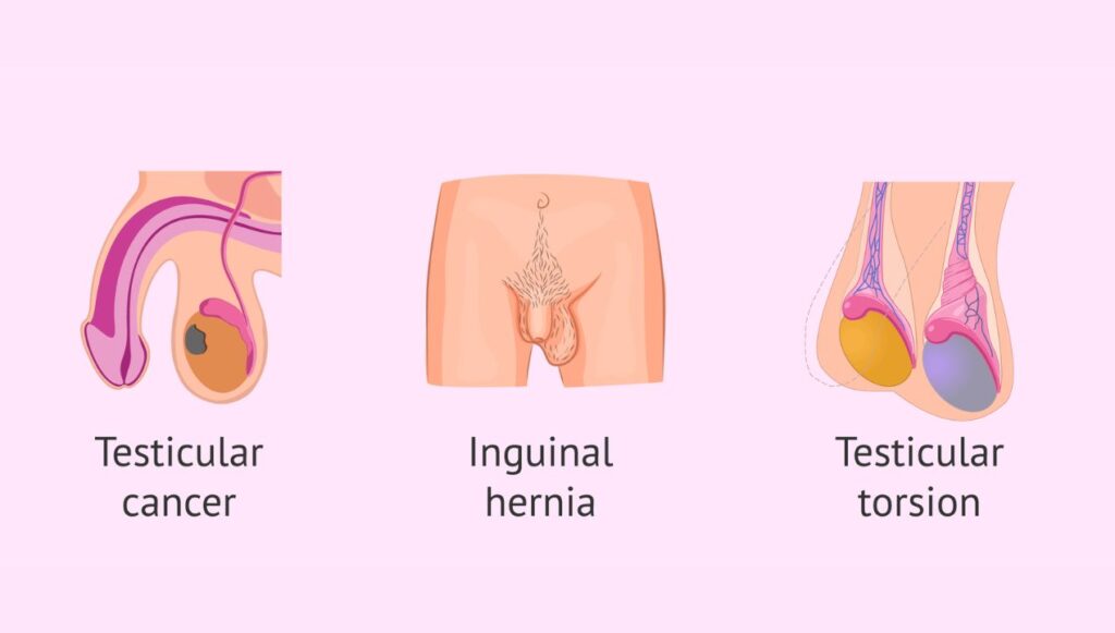 اضرار الخصية المعلقة