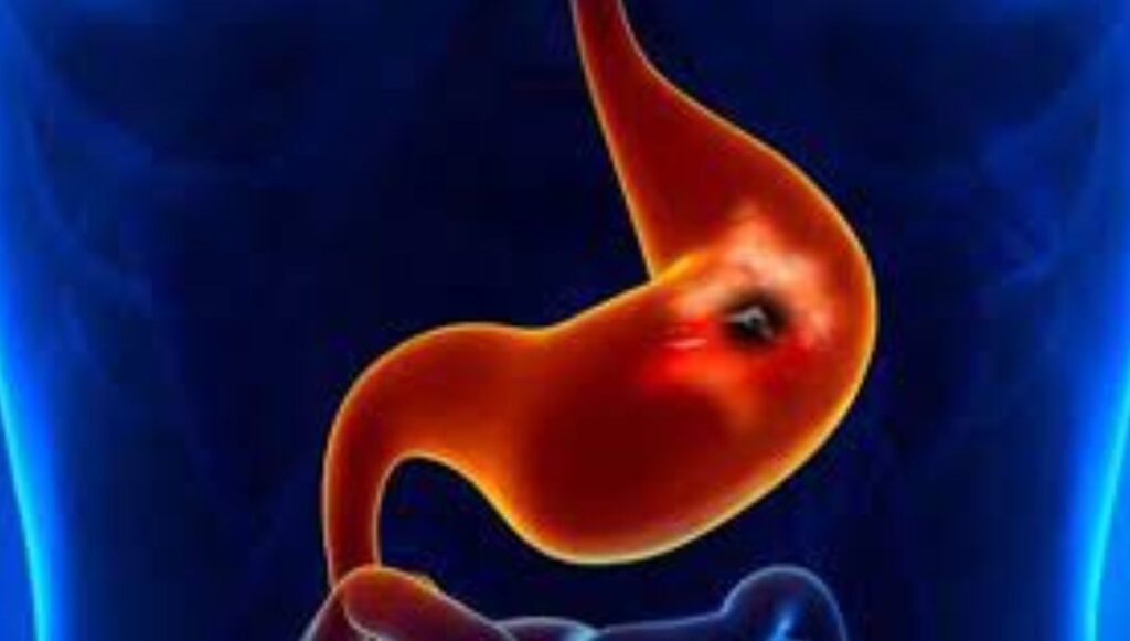 اعراض التهاب الجهاز الهضمي