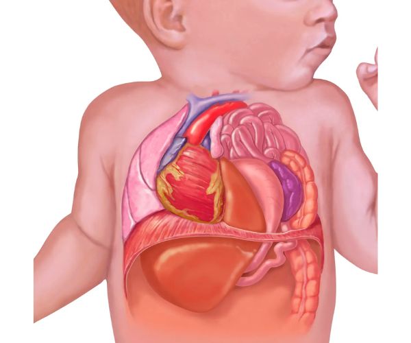 شكل الحجاب الحاجز عند الاطفال