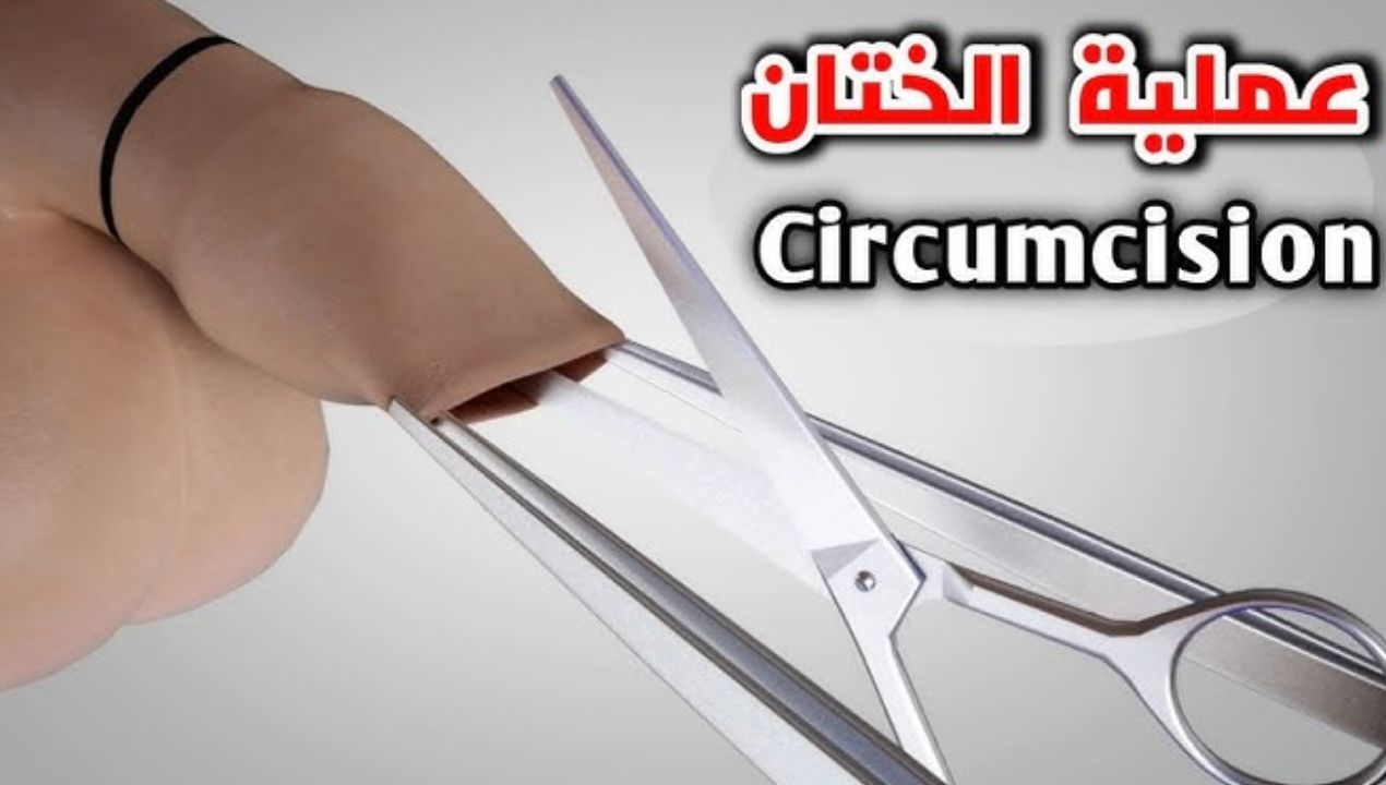 ما الفرق بين الختان وعدمه؟ .. بالصور