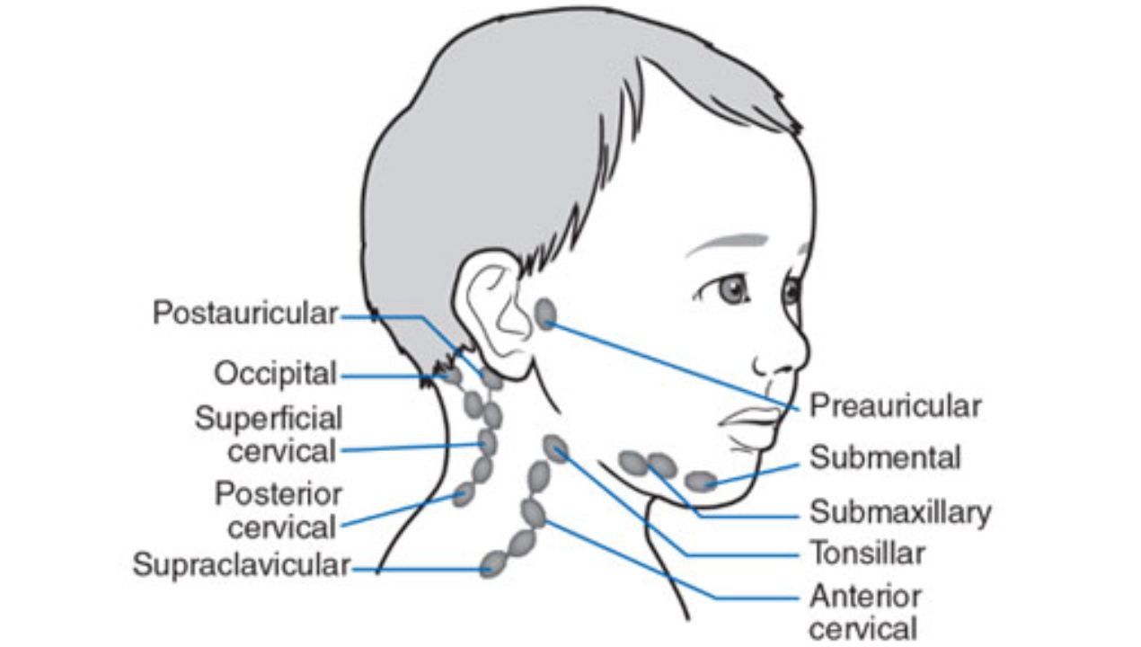 أسباب التهاب الغدد الليمفاوية عند الاطفال وطرق علاجها