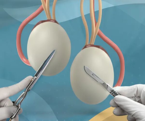 عملية الخصية المعلقة