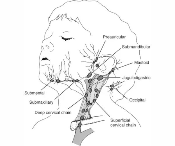 التهاب الغدد الليمفاوية
