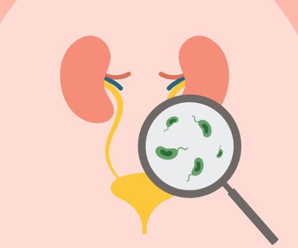 التهاب الاحليل