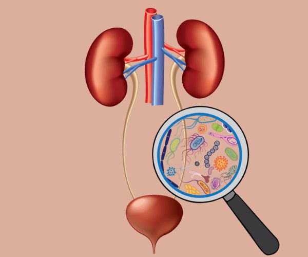 التهاب الاحليل