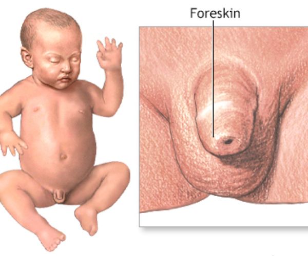 مراحل شفاء الختان