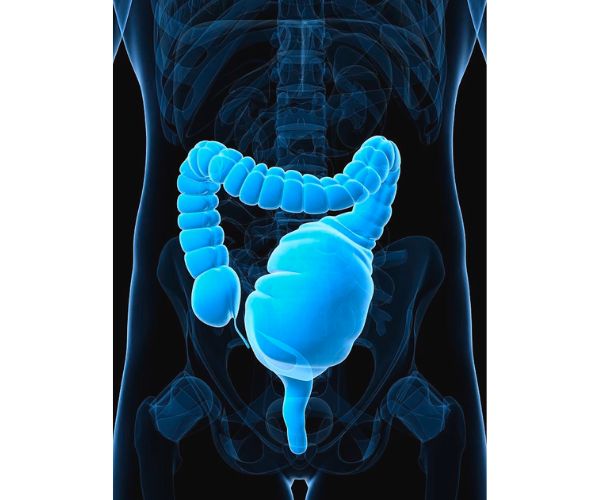 اعراض تضخم القولون