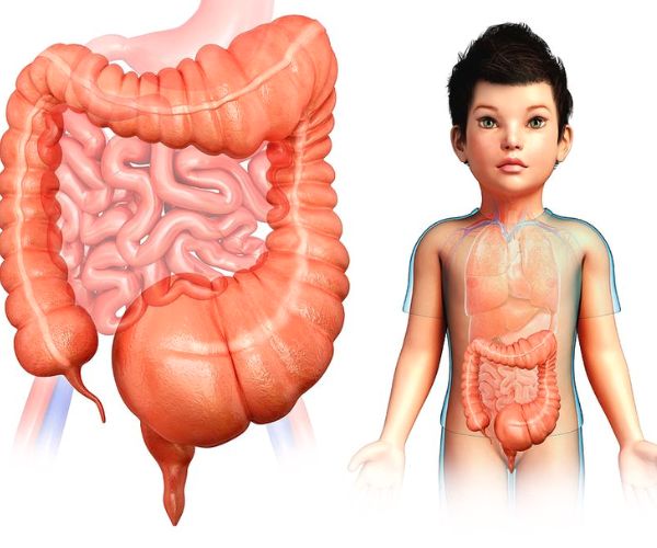 اعراض تضخم القولون
