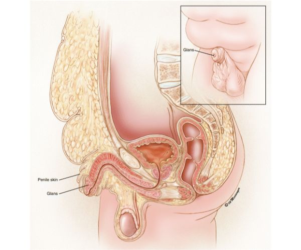 القضيب المدفون