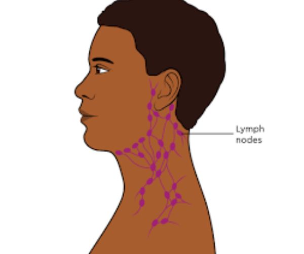 بالصور الغدد اللمفاوية