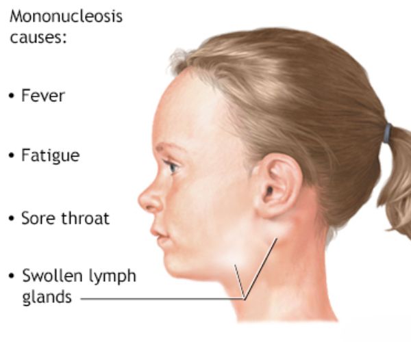 بالصور الغدد اللمفاوية
