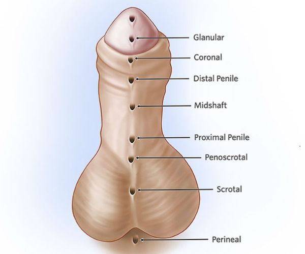 الطهور الملائكي