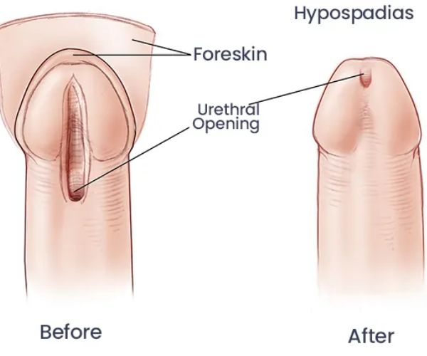 الطهور الملائكي