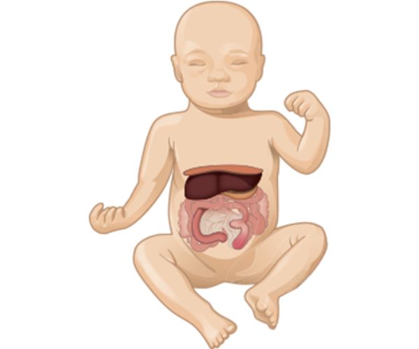 انسداد فتحة المريء للجنين في بطن الأم