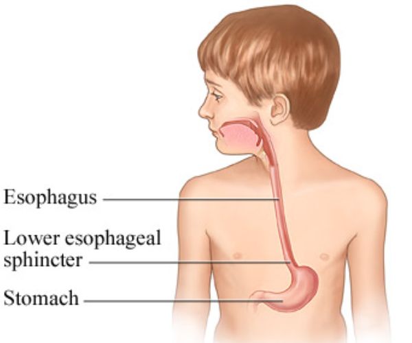 عملية توسيع المريء بالبالون للاطفال
