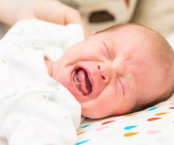 اللسان المربوط عند الرضع