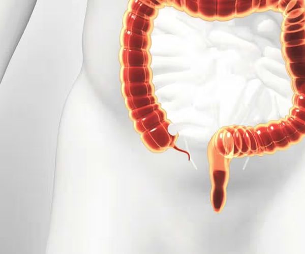 الزائدة الدودية