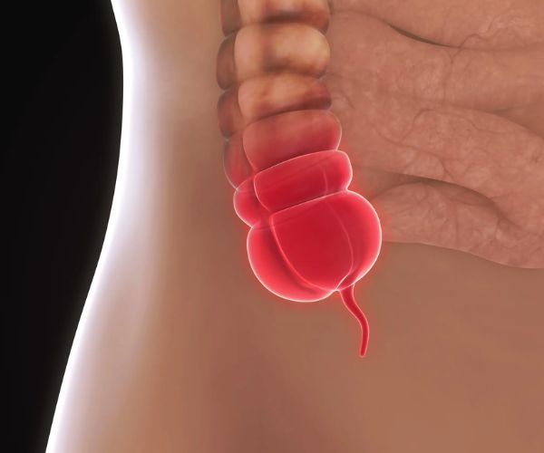 الزائدة الدودية