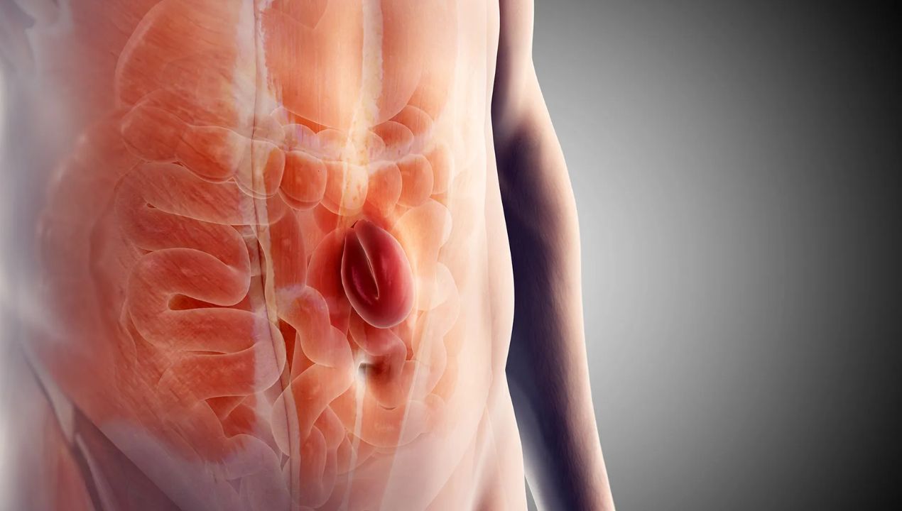 اعراض الفتق اسفل البطن وأهم العلامات المبكرة للتشخيص