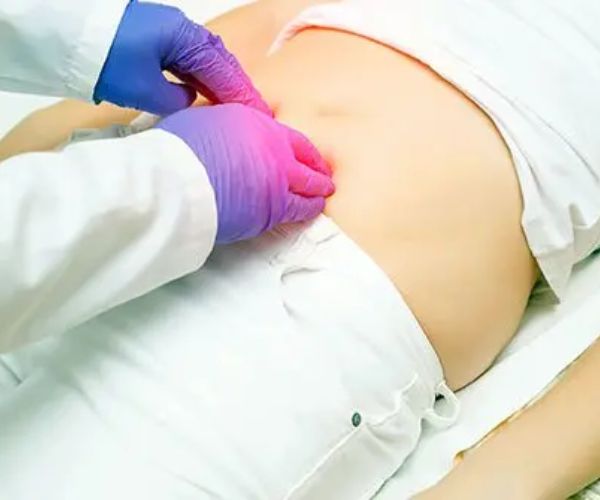 علاج الفتق الإربي بدون جراحة