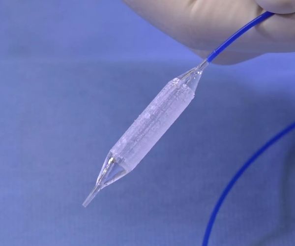 عملية توسيع مجري البول للاطفال