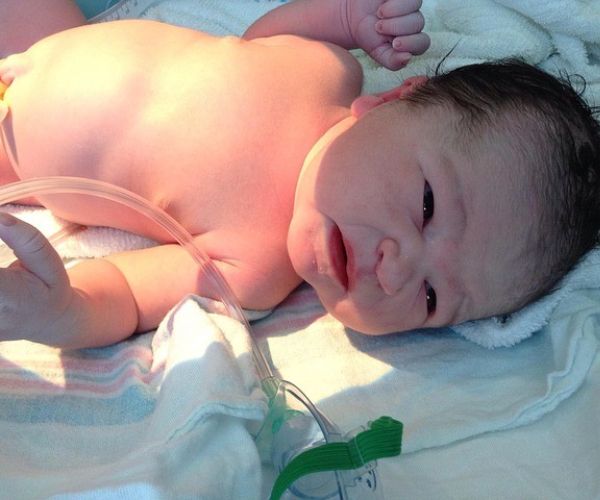 رتق القناة الصفراوية عند الأطفال