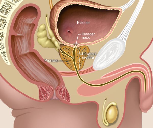 تشوهات الجهاز البولي عند الأطفال