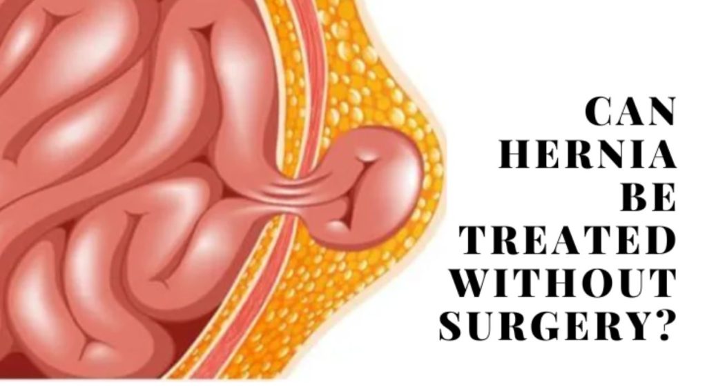 علاج الفتق الإربي بدون جراحة