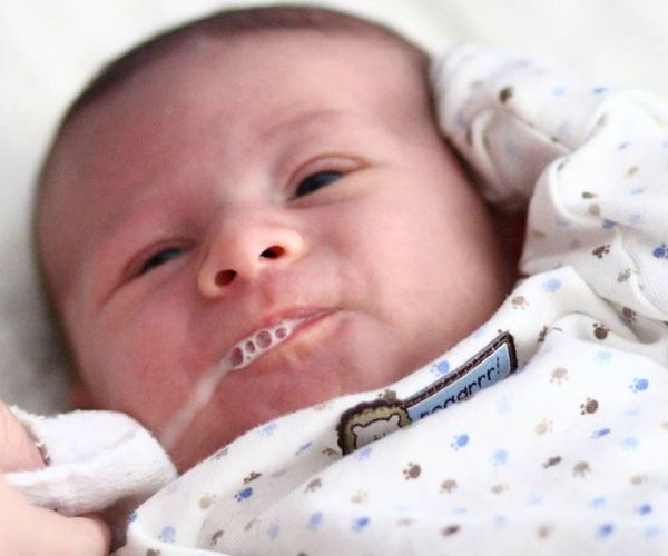 ارتجاع المريء عند الرضع