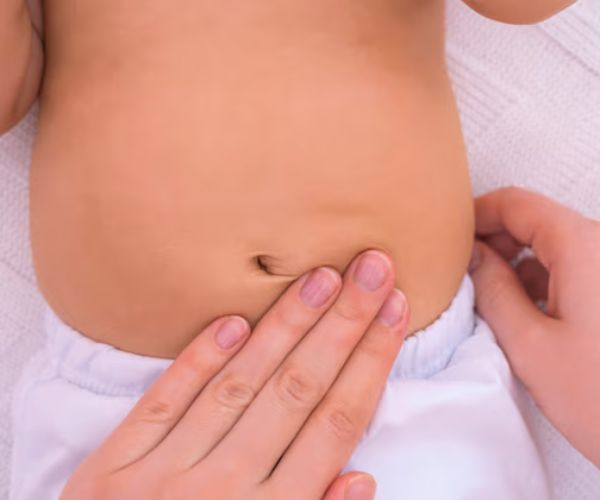 عراض الفتق عند الأطفال البنات